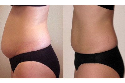 Sculpted Contours Luxury Medical Aesthetics - Sculpted Contours Luxury Medical Aesthetics