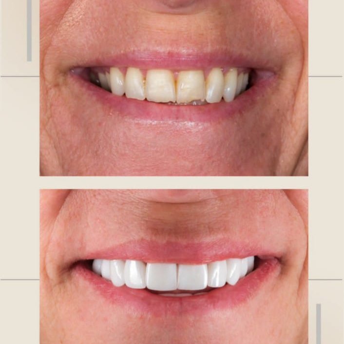 SDC Antalya Smile Studio - Sirinyali Dental Clinic - SDC Antalya Smile Studio - Sirinyali Dental Clinic