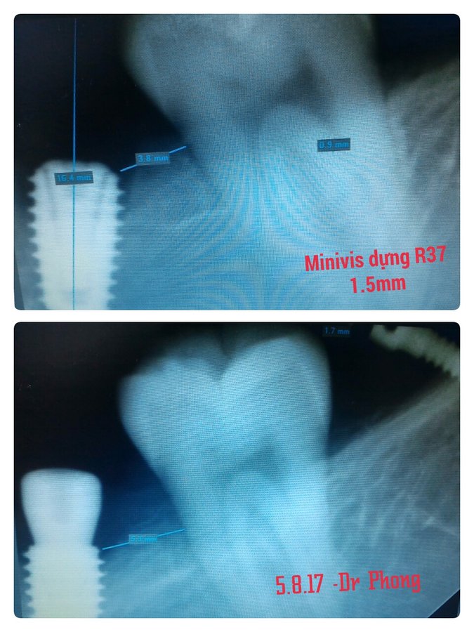 SEA Dental Clinic - نها خوا NG NAM - SEA Dental Clinic - Nha khoa ĐÔNG NAM Á