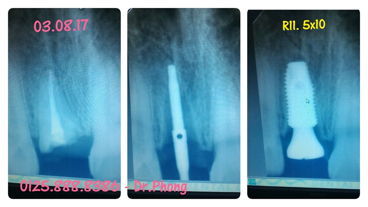 SEA Dental Clinic - نها خوا NG NAM - SEA Dental Clinic - Nha khoa ĐÔNG NAM Á