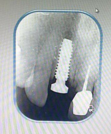SEA Dental Clinic - نها خوا NG NAM - SEA Dental Clinic - Nha khoa ĐÔNG NAM Á