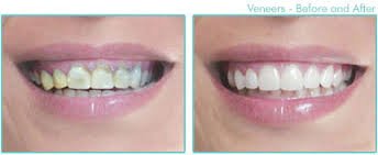 Segambut Dental Clinic - Segambut Dental Clinic