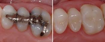 Segambut Dental Clinic - Segambut Dental Clinic