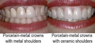 Segambut Dental Clinic - Segambut Dental Clinic