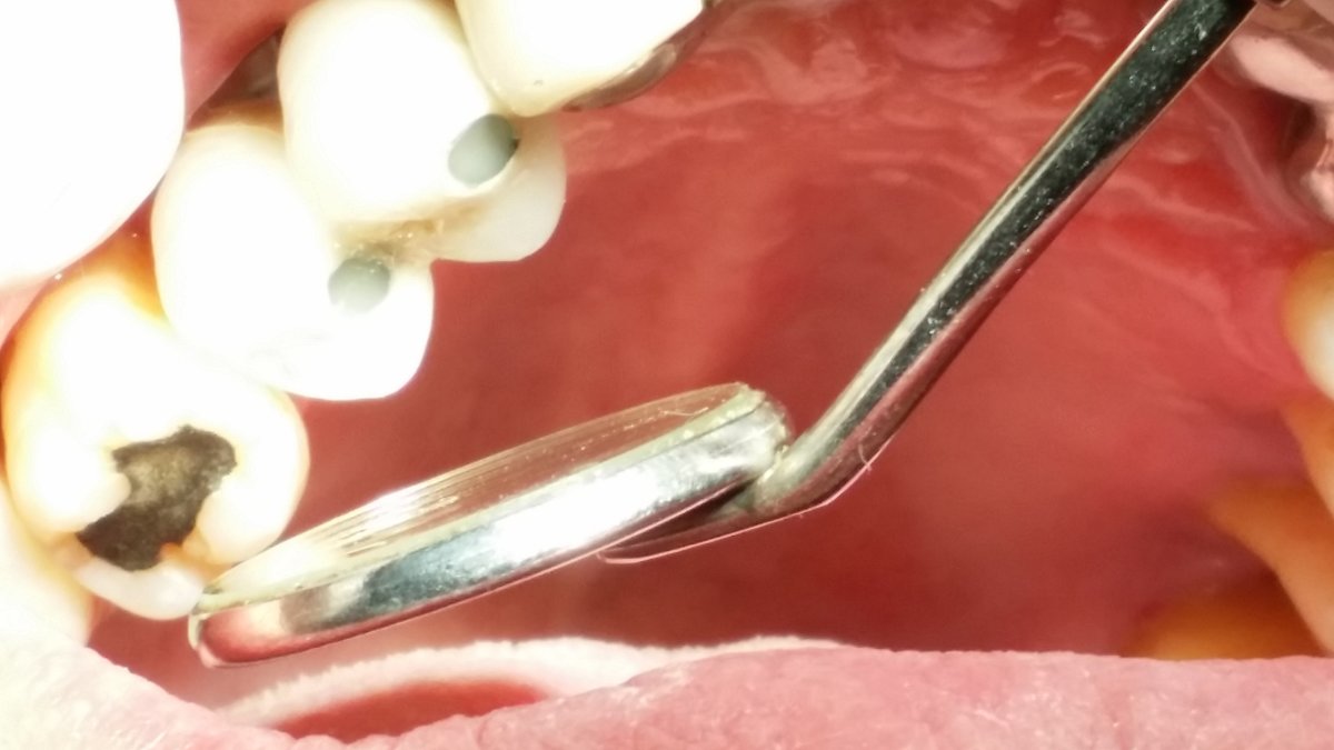 Segambut Dental Clinic - Segambut Dental Clinic