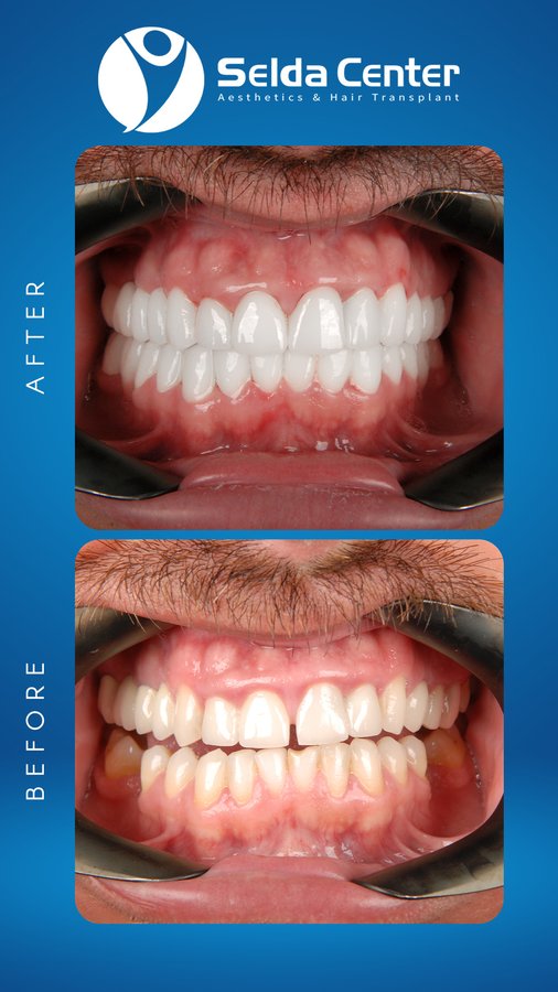 Selda Hair Center - Selda Hair Center