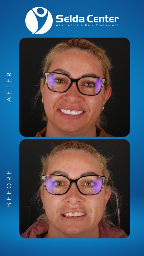 Selda Hair Center - Selda Hair Center