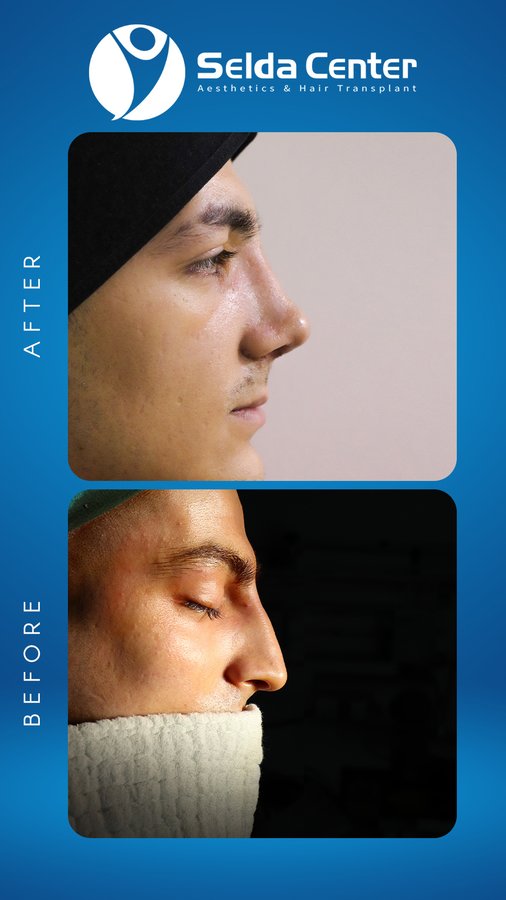 Selda Hair Center - Selda Hair Center