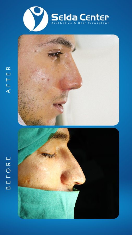 Selda Hair Center - Selda Hair Center