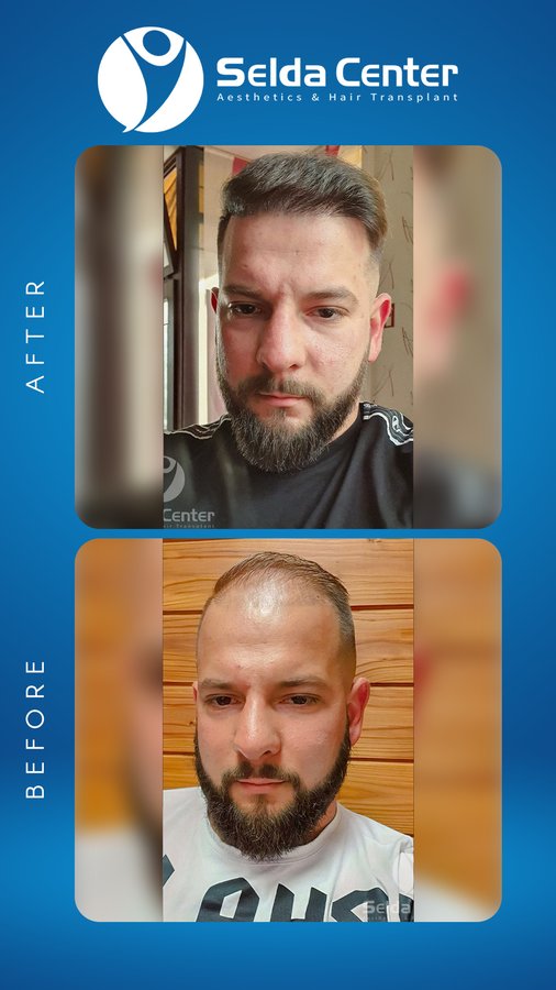 Selda Hair Center - Selda Hair Center