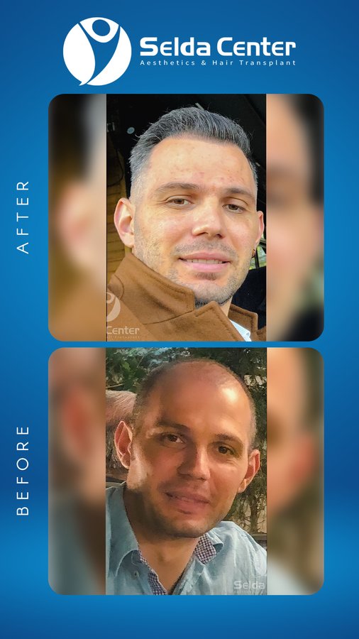 Selda Hair Center - Selda Hair Center