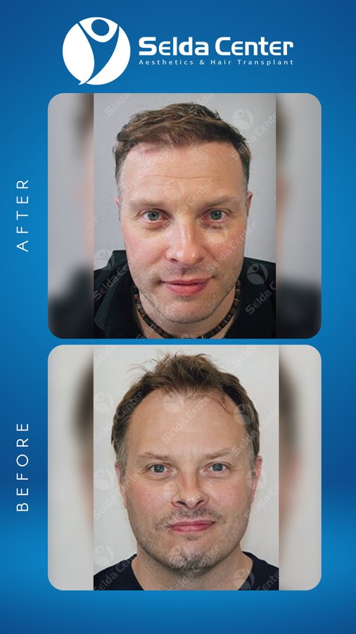 Selda Hair Center - Selda Hair Center