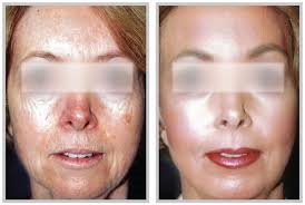 Selin Laser MedSpa - Selin Laser MedSpa