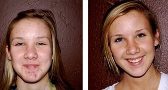 Selin Laser MedSpa - Selin Laser MedSpa