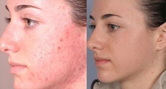 Selin Laser MedSpa - Selin Laser MedSpa