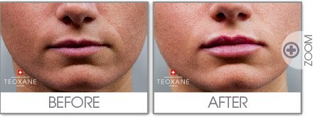 Selin Laser MedSpa - Selin Laser MedSpa