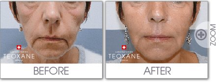 Selin Laser MedSpa - Selin Laser MedSpa