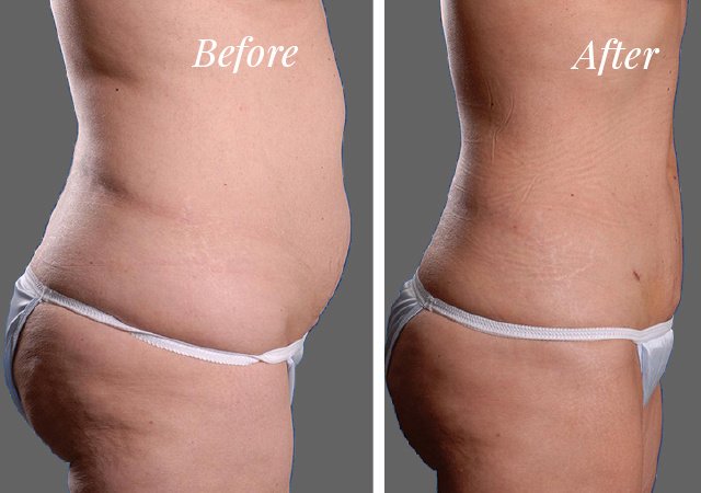 Selin Laser MedSpa - Selin Laser MedSpa