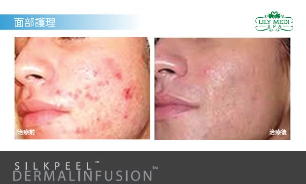 Selin Laser MedSpa - Selin Laser MedSpa