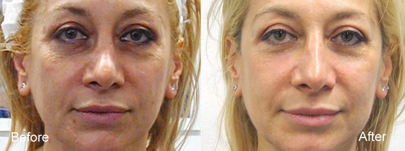 Selin Laser MedSpa - Selin Laser MedSpa