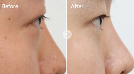 Selin Laser MedSpa - Selin Laser MedSpa