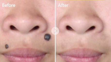 Selin Laser MedSpa - Selin Laser MedSpa