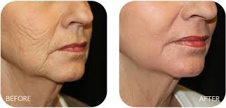 Selin Laser MedSpa - Selin Laser MedSpa