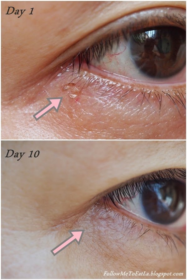 Selin Laser MedSpa - Selin Laser MedSpa