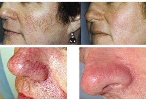 Selin Laser MedSpa - Selin Laser MedSpa