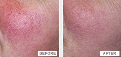 Selin Laser MedSpa - Selin Laser MedSpa