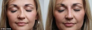 Selin Laser MedSpa - Selin Laser MedSpa