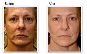 Selin Laser MedSpa - Selin Laser MedSpa