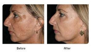 Selin Laser MedSpa - Selin Laser MedSpa