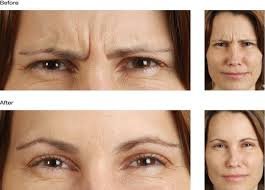 Selin Laser MedSpa - Selin Laser MedSpa