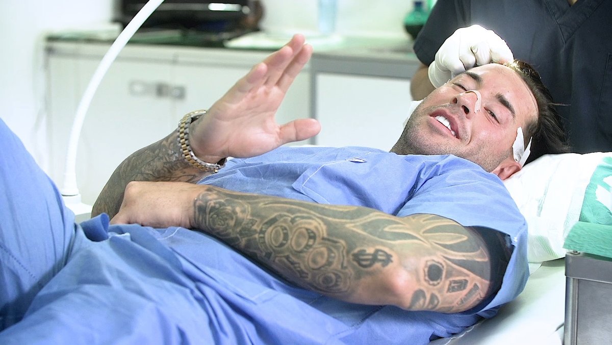 Seneca Hair Transplant - Athens - Seneca Hair Transplant - Athens