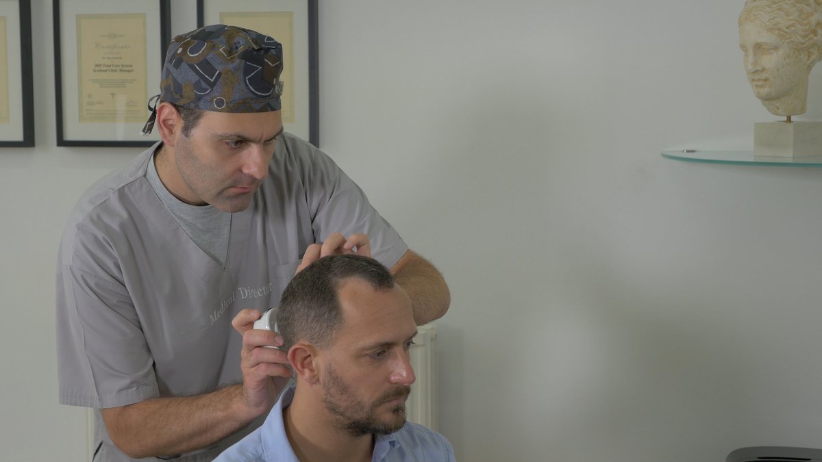 Seneca Hair Transplant - Athens - Seneca Hair Transplant - Athens