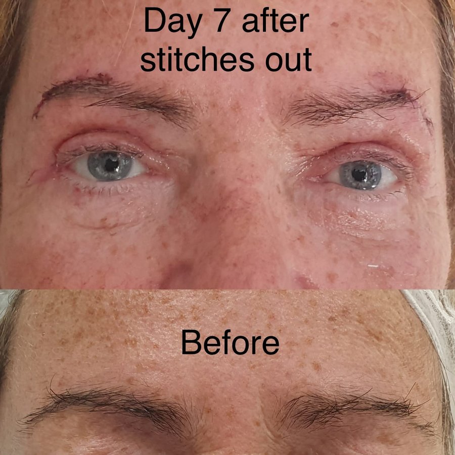 Serkan Dağdelen - Serkan Dağdelen