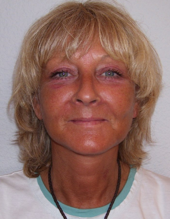 Severo Cosmetic Surgery - Severo Cosmetic Surgery