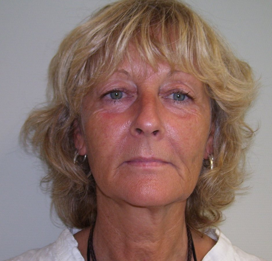 Severo Cosmetic Surgery - Severo Cosmetic Surgery