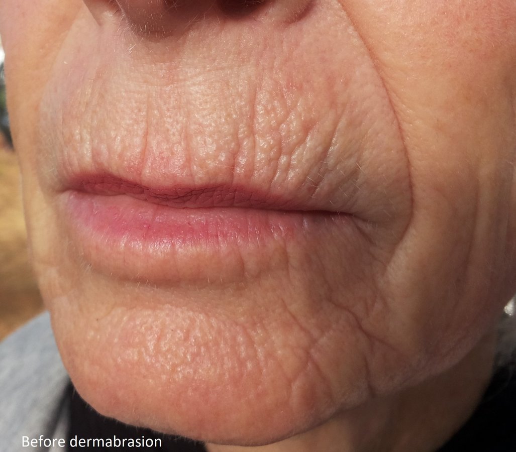 Severo Cosmetic Surgery - Severo Cosmetic Surgery