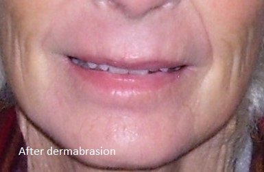 Severo Cosmetic Surgery - Severo Cosmetic Surgery
