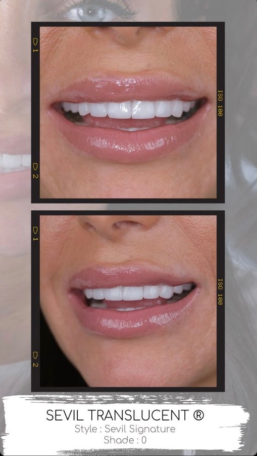 Sevil Smile Studio - Sevil Smile Studio