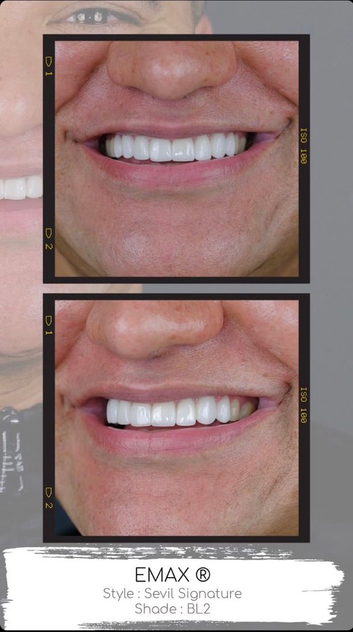 Sevil Smile Studio - Sevil Smile Studio