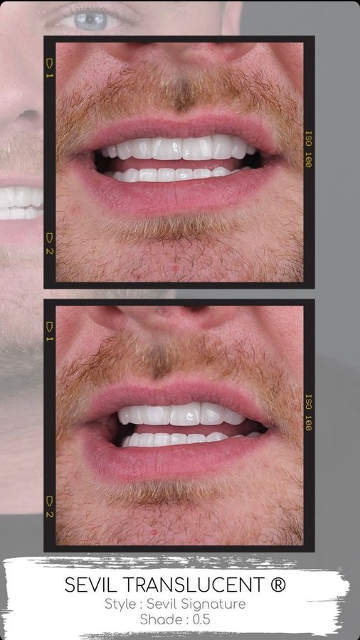 Sevil Smile Studio - Sevil Smile Studio