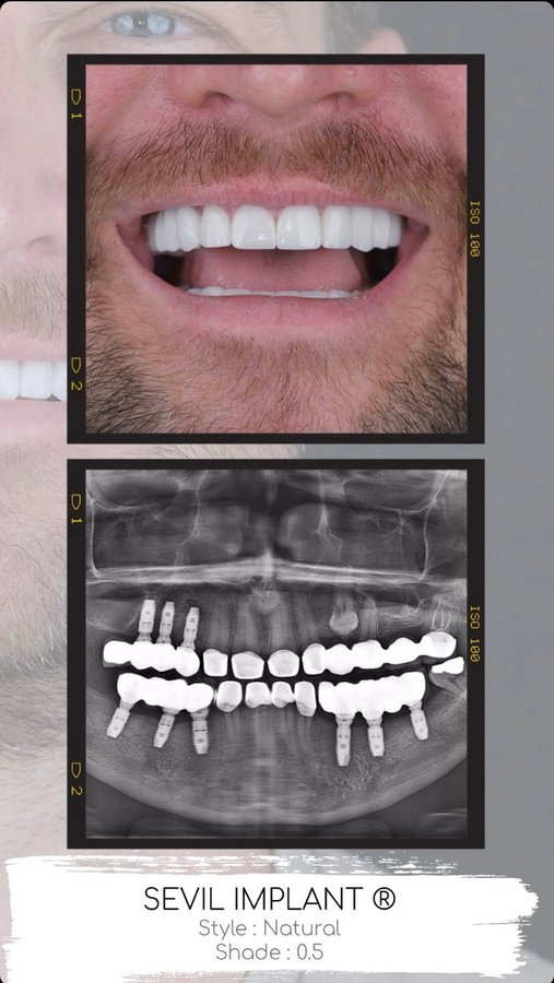 Sevil Smile Studio - Sevil Smile Studio