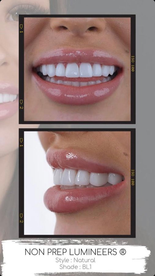 Sevil Smile Studio - Sevil Smile Studio