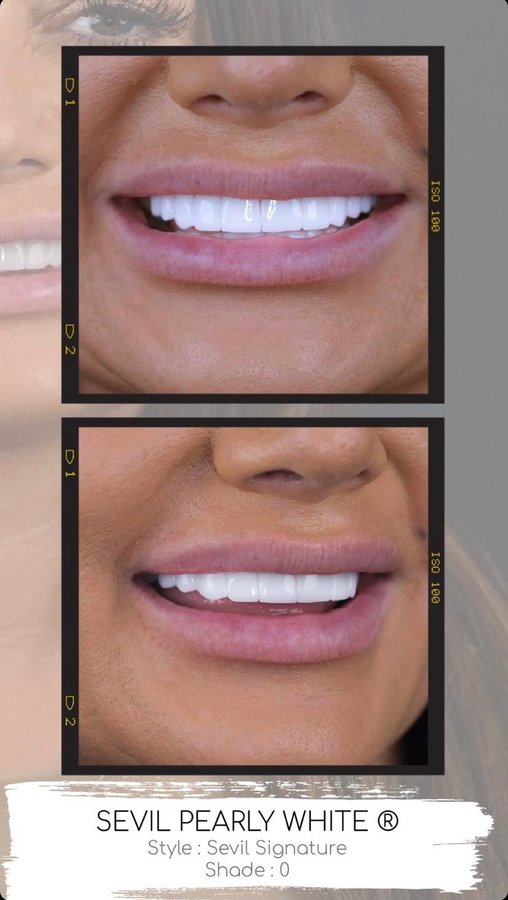 Sevil Smile Studio - Sevil Smile Studio