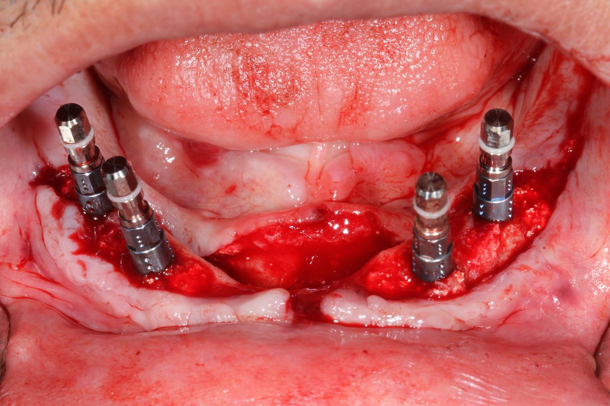 SG Dental Clinic - SG Dental Clinic