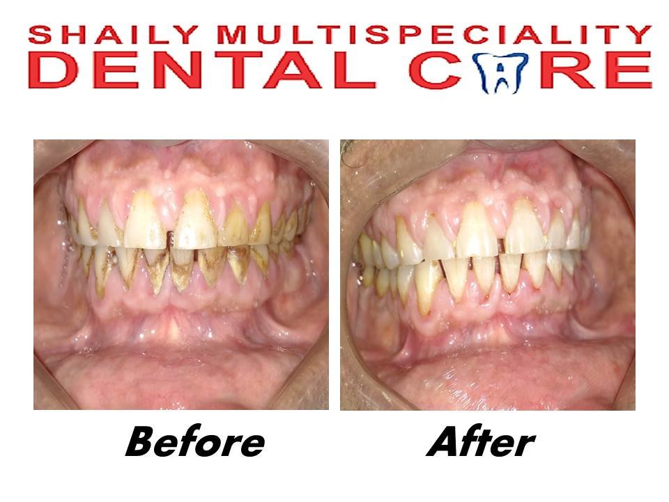 Shaily Multispeciality dental care - Shaily Multispeciality dental care