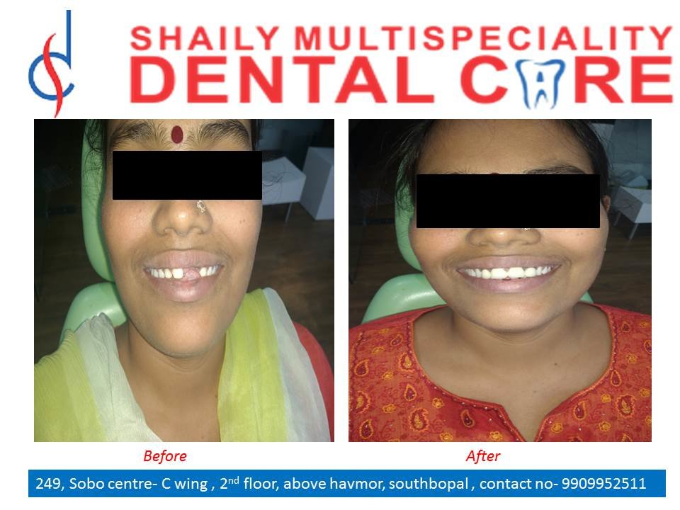 Shaily Multispeciality dental care - Shaily Multispeciality dental care